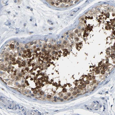 Immunohistochemistry-Paraffin: C21orf59 Antibody [NBP1-88276] - Staining of human testis shows cytoplasmic positivity in cells of seminiferus ducts.