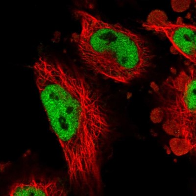 Immunocytochemistry/Immunofluorescence: ATN1 Antibody [NBP1-90044] - Immunofluorescent staining of human cell line U-251 MG shows localization to nucleoplasm.