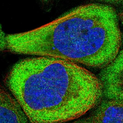 Immunocytochemistry/Immunofluorescence: CPNE5 Antibody [NBP1-84406] - Immunofluorescent staining of human cell line A-431 shows localization to cytosol.