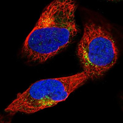Immunocytochemistry/Immunofluorescence: SP17 Antibody [NBP1-85409] - Immunofluorescent staining of human cell line U-2 OS shows localization to vesicles.