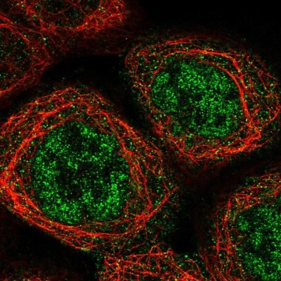 Immunocytochemistry/Immunofluorescence: SH3GL3 Antibody [NBP1-84419] - Staining  of human cell line A-431 shows positivity in nucleus but not nucleoli and cytoplasm.