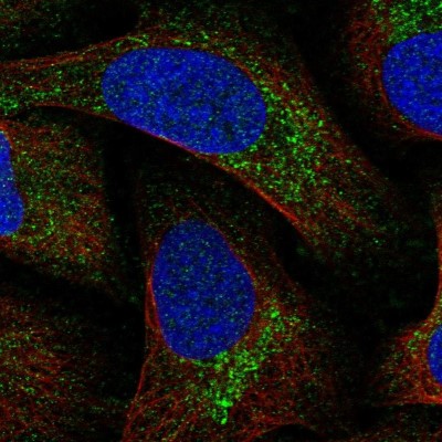 Immunocytochemistry/Immunofluorescence: MITD1 Antibody [NBP1-82828] - Immunofluorescent staining of human cell line U-2 OS shows localization to vesicles.