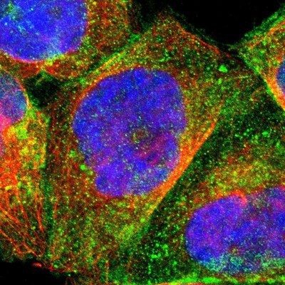 Immunocytochemistry/Immunofluorescence: Desmoglein-2 Antibody [NBP1-85709] - Staining of human cell line A-431 shows positivity in plasma membrane.