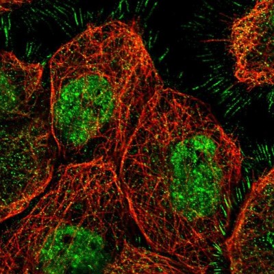 Immunocytochemistry/Immunofluorescence: SETDB1 Antibody [NBP1-84790] - Staining of human cell line A-431 shows positivity in nucleus but not nucleoli, plasma membrane and cytoplasm.