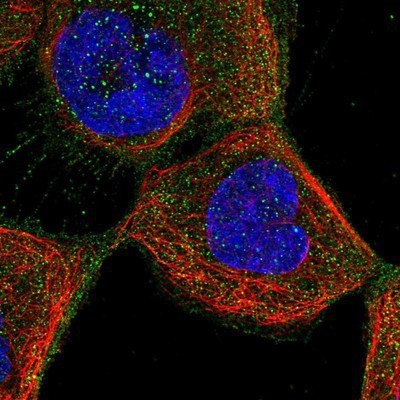 Immunocytochemistry/Immunofluorescence: CRLF1 Antibody [NBP1-85605] - Staining of human cell line A-431 shows positivity in plasma membrane and cytoplasm.