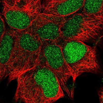 Immunocytochemistry/Immunofluorescence: CCDC106 Antibody [NBP2-30390] - Staining of human cell line HEK 293 shows positivity in nucleus.