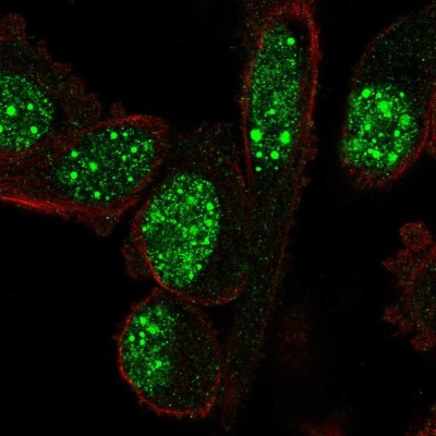 Immunocytochemistry/Immunofluorescence: NOP10 Antibody [NBP2-32441] - Immunofluorescent staining of human cell line PC-3 shows localization to nuclear bodies.