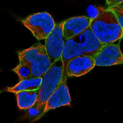 Immunocytochemistry/Immunofluorescence: gamma Adducin Antibody [NBP2-34017] - Staining of human cell line HEK 293 shows localization to plasma membrane.