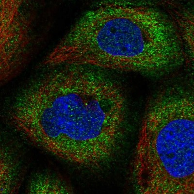 Immunocytochemistry/Immunofluorescence: CNKSR1 Antibody [NBP1-84420] - Immunofluorescent staining of human cell line A-431 shows localization to cytosol.
