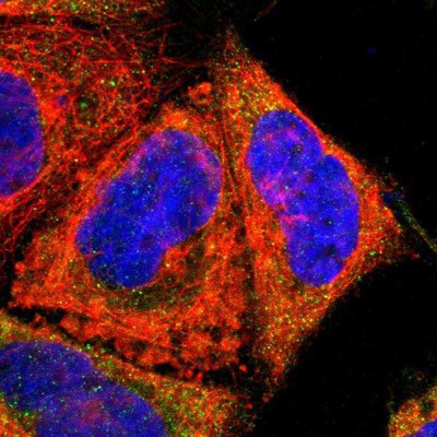 Immunocytochemistry/Immunofluorescence: Testisin Antibody [NBP1-84789] Staining of human cell line A-431 shows positivity in cytoplasm.