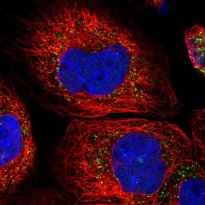 Immunocytochemistry/Immunofluorescence: ACOX3 Antibody [NBP1-85901] - Staining of human cell line A-431 shows localization to peroxisomes.