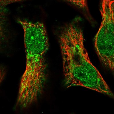 Immunocytochemistry/Immunofluorescence: Pyruvate Dehydrogenase Phosphatase/PDP1/PPM2C Antibody [NBP1-82432] - Immunofluorescent staining of human cell line U-2 OS shows localization to nucleoplasm, cytosol & mitochondria.