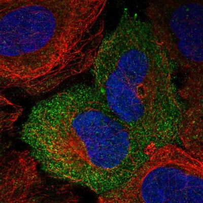 Immunocytochemistry/Immunofluorescence: Nectin-4/PVRL4 Antibody [NBP1-82829] - Staining of human cell line U-2 OS shows localization to plasma membrane.