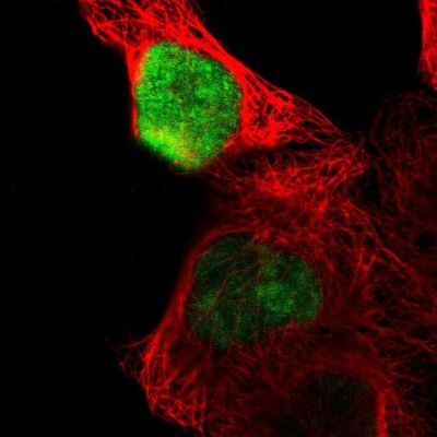 Immunocytochemistry/Immunofluorescence: OVOL1 Antibody [NBP1-89469] - Immunofluorescent staining of human cell line A-431 shows localization to nucleus.