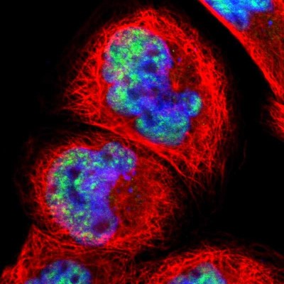 Immunocytochemistry/Immunofluorescence: Pinin Antibody [NBP1-87784] - Immunofluorescent staining of human cell line A-431 shows localization to nuclear speckles.
