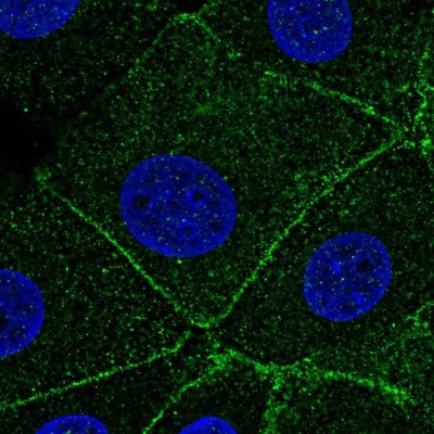 Immunocytochemistry/Immunofluorescence: ARPC1A Antibody [NBP1-88851] - Immunofluorescent staining of human cell line MCF7 shows localization to cytosol & cell junctions.