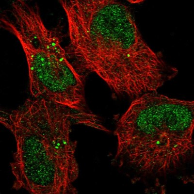 Immunocytochemistry/Immunofluorescence: KDELC2 Antibody [NBP1-92047] - Immunofluorescent staining of human cell line U-251 MG shows localization to nucleoplasm & vesicles.