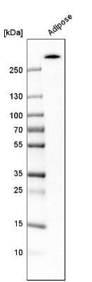 Western Blot: Acetyl Coenzyme A Carboxylase Beta Antibody [NBP1-90274] - Analysis in human adipose tissue.
