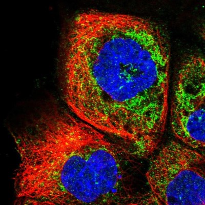 Immunocytochemistry/Immunofluorescence: RDH13 Antibody [NBP1-92324] - Staining of human cell line A-431 shows localization to cytosol & mitochondria.
