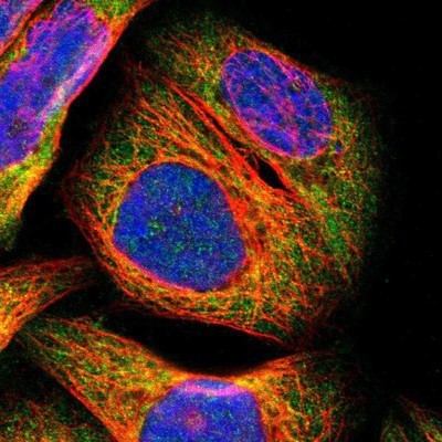 Immunocytochemistry/Immunofluorescence: PARP14 Antibody [NBP1-93592] - Staining of human cell line A-431 shows positivity in cytoplasm.