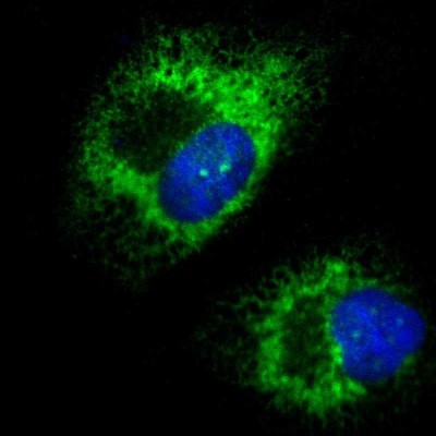 Immunocytochemistry/Immunofluorescence: kinectin Antibody [NBP1-90634] - Immunofluorescent staining of human cell line U-251 MG shows localization to endoplasmic reticulum.