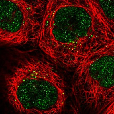 Immunocytochemistry/Immunofluorescence: SRGAP3 Antibody [NBP1-88831] - Staining of human cell line A-431 shows positivity in nucleus but not nucleoli and vesicles.