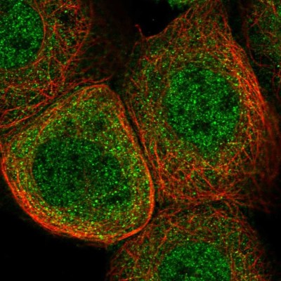 Immunocytochemistry/Immunofluorescence: SRGAP2 Antibody [NBP1-88830] - Immunofluorescent staining of human cell line A-431 shows localization to nucleoplasm & cytosol.