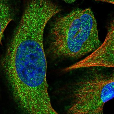 Immunocytochemistry/Immunofluorescence: SRGAP2 Antibody [NBP1-88830] - Staining of human cell line U-2 OS shows positivity in cytoplasm.