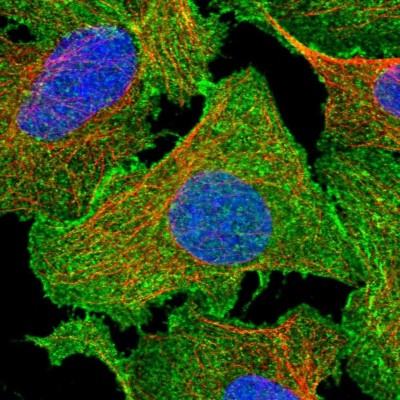 Immunocytochemistry/Immunofluorescence: EPB41L5 Antibody [NBP2-38354] - Immunofluorescent staining of human cell line U-2 OS shows localization to plasma membrane.