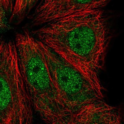 Immunocytochemistry/Immunofluorescence: ADPRHL1 Antibody [NBP2-39073] - Staining of human cell line MCF7 shows localization to nucleoplasm.