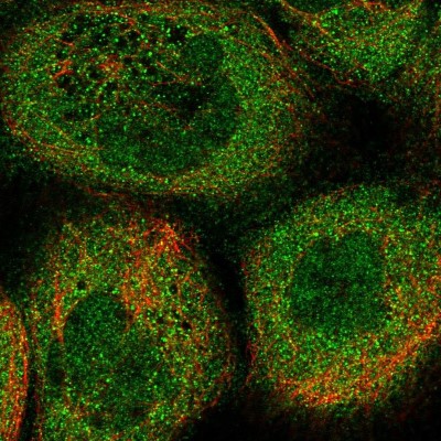 Immunocytochemistry/Immunofluorescence: HLRC1 Antibody [NBP1-91994] - Immunofluorescent staining of human cell line A-431 shows localization to nucleus & cytosol.