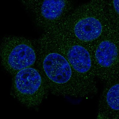 Immunocytochemistry/Immunofluorescence: SMPD4 Antibody [NBP2-33567] - Staining of human cell line MCF7 shows localization to nuclear membrane.