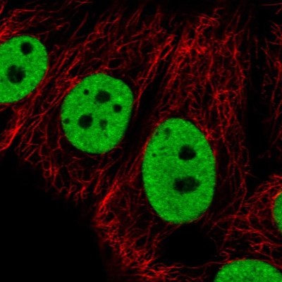 Immunocytochemistry/Immunofluorescence: hnRNP G Antibody [NBP2-34152] - Staining of human cell line MCF7 shows localization to nucleoplasm.