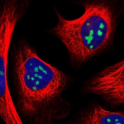 Immunocytochemistry/Immunofluorescence: RRS1 Antibody [NBP2-30725] - Immunofluorescent staining of human cell line U-2 OS shows localization to nucleoli.