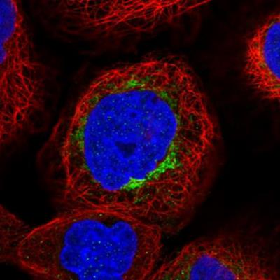 Immunocytochemistry/Immunofluorescence: IVD Antibody [NBP2-30578] - Staining  of human cell line A-431 shows positivity in mitochondria. Antibody staining is shown in green.