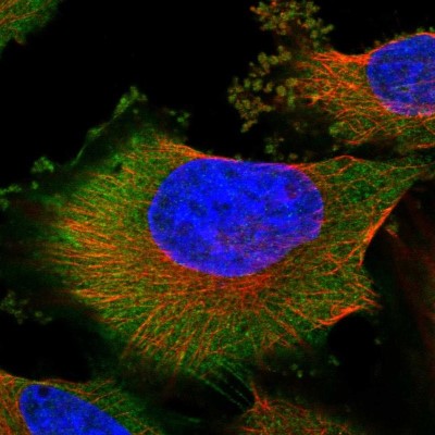 Immunocytochemistry/Immunofluorescence: CGI 62 Antibody [NBP1-88246] - Immunofluorescent staining of human cell line U-251 MG shows localization to cytosol.