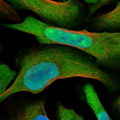 Immunocytochemistry/Immunofluorescence: MAGED2 Antibody [NBP1-89413] - Staining of human cell line U-2 OS shows positivity in nucleus, nucleoli and cytoplasm.