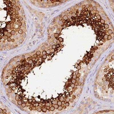 Immunohistochemistry-Paraffin: Ropporin 1-like Antibody [NBP1-90081] - Staining of human testis shows strong cytoplasmic positivity in cells in seminiferus ducts.
