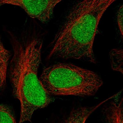 Immunocytochemistry/Immunofluorescence: LASS6 Antibody [NBP1-92068] - Staining of human cell line U-2 OS shows positivity in nucleus.