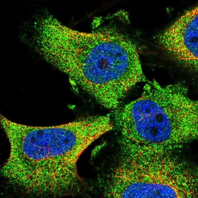 Immunocytochemistry/Immunofluorescence: GRAF Antibody [NBP2-38235] - Immunofluorescent staining of human cell line U-251 MG shows localization to cytosol.