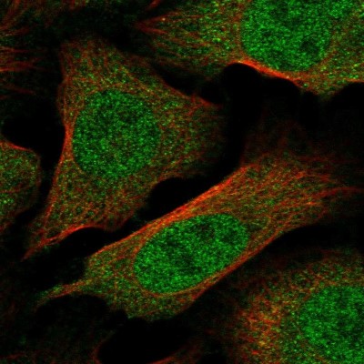 Immunocytochemistry/Immunofluorescence: Importin alpha 5/KPNA1/SRP1 Antibody [NBP2-47418] - Immunofluorescent staining of human cell line U-2 OS shows localization to nucleoplasm & cytosol.