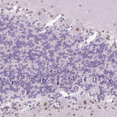 Immunohistochemistry-Paraffin: Importin alpha 5/KPNA1/SRP1 Antibody [NBP2-47418] - Staining  human cerebellum shows moderate nuclear positivity in Purkinje cells.