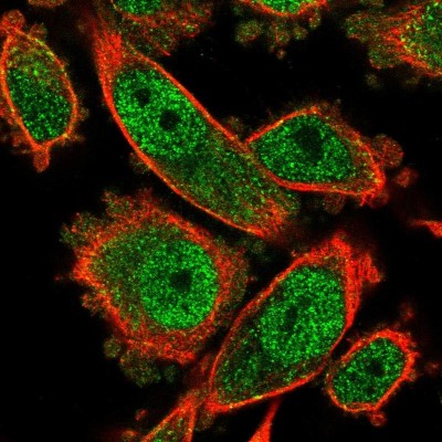 Immunocytochemistry/Immunofluorescence: SAH3 Antibody [NBP2-47293] - Immunofluorescent staining of human cell line PC-3 shows localization to nucleoplasm & cytosol.