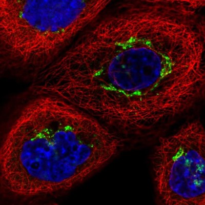 Immunocytochemistry/Immunofluorescence: TJAP1 Antibody [NBP2-38152] - Immunofluorescent staining of human cell line A-431 shows localization to the Golgi apparatus.