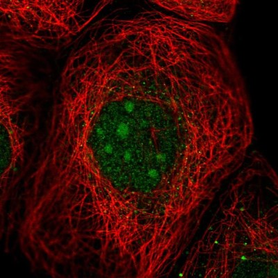 Immunocytochemistry/Immunofluorescence: UTP23 Antibody [NBP1-92568] - Immunofluorescent staining of human cell line A-431 shows localization to nucleoli.