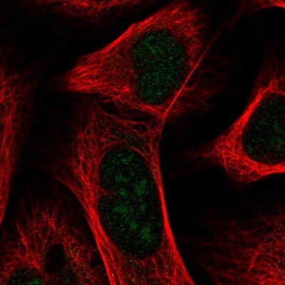 Immunocytochemistry/Immunofluorescence: UTP23 Antibody [NBP1-92568] - Staining of human cell line U-2 OS shows positivity in nucleus and nucleoli.