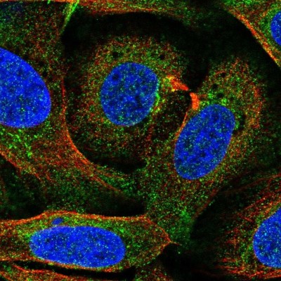 Immunocytochemistry/Immunofluorescence: Ferroportin/SLC40A1 Antibody [NBP2-49454] - Staining of human cell line U-2 OS shows localization to plasma membrane & cytosol.