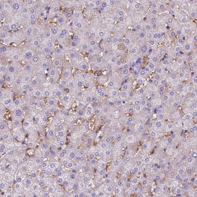 Immunohistochemistry-Paraffin: Ferroportin/SLC40A1 Antibody [NBP2-49454] - Staining of human liver shows strong positivity in liver sinusoids.