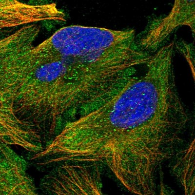 Immunocytochemistry/Immunofluorescence: katanin-p80 Antibody [NBP1-87413] - Immunofluorescent staining of human cell line U-2 OS shows localization to plasma membrane, cytosol & microtubules.