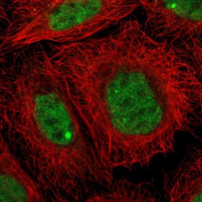 Immunocytochemistry/Immunofluorescence: ZNF350 Antibody [NBP1-80608] - Staining of human cell line A-431 shows localization to nucleoplasm & nuclear bodies.